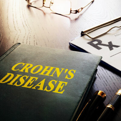 Top 10 early warning signs of Crohn’s